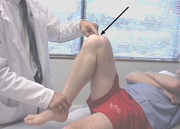Bolečina v kolenu med upogibanjem je najpogostejši razlog, zakaj ljudje obiščejo zdravnike travme. 