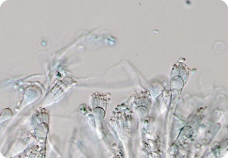 Ena izmed gliv iz rodu Aspergillus 