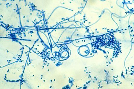 Vzročni dejavnik epidermofitoze stopal (Trichophyton interdigitale)